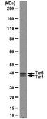 Anti-Tropomyosin Antibody, clone 15D12.2 clone 15D12.2, from mouse