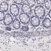Anti-TECPR2 antibody produced in rabbit Prestige Antibodies&#174; Powered by Atlas Antibodies, affinity isolated antibody, buffered aqueous glycerol solution
