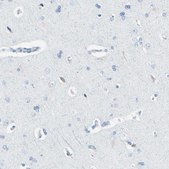 Anti-TPO antibody produced in rabbit Prestige Antibodies&#174; Powered by Atlas Antibodies, affinity isolated antibody, buffered aqueous glycerol solution