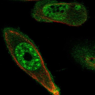 Anti-STK17A antibody produced in rabbit Prestige Antibodies&#174; Powered by Atlas Antibodies, affinity isolated antibody