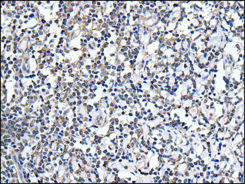 Anti-PLAG1 affinity isolated antibody