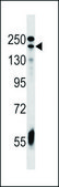 ANTI-ADCY9 (C-TERM) antibody produced in rabbit IgG fraction of antiserum, buffered aqueous solution