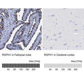Anti-RSPH1 antibody produced in rabbit Prestige Antibodies&#174; Powered by Atlas Antibodies, affinity isolated antibody, buffered aqueous glycerol solution