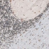 Anti-TET1 antibody produced in rabbit Prestige Antibodies&#174; Powered by Atlas Antibodies, affinity isolated antibody, buffered aqueous glycerol solution