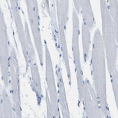 Anti-CNN1 antibody produced in rabbit Prestige Antibodies&#174; Powered by Atlas Antibodies, affinity isolated antibody, buffered aqueous glycerol solution
