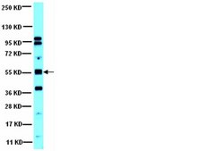 Anti-PP2A Antibody, B &#946; subunit from rabbit, purified by affinity chromatography