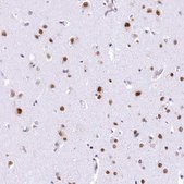 Anti-HNRNPA0 antibody produced in rabbit Prestige Antibodies&#174; Powered by Atlas Antibodies, affinity isolated antibody, buffered aqueous glycerol solution