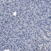 Anti-KCNC3 antibody produced in rabbit Prestige Antibodies&#174; Powered by Atlas Antibodies, affinity isolated antibody, buffered aqueous glycerol solution