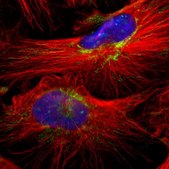 Anti-MRPL40 antibody produced in rabbit Prestige Antibodies&#174; Powered by Atlas Antibodies, affinity isolated antibody, buffered aqueous glycerol solution