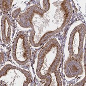 Anti-WASF2 antibody produced in rabbit Prestige Antibodies&#174; Powered by Atlas Antibodies, affinity isolated antibody, buffered aqueous glycerol solution