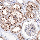 Anti-RDX antibody produced in rabbit Ab1, Prestige Antibodies&#174; Powered by Atlas Antibodies, affinity isolated antibody, buffered aqueous glycerol solution