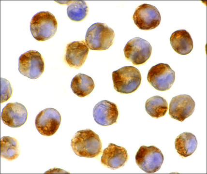 Anti-IL-21 antibody produced in rabbit affinity isolated antibody, buffered aqueous solution