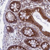 Anti-CLINT1 antibody produced in rabbit Prestige Antibodies&#174; Powered by Atlas Antibodies, affinity isolated antibody, buffered aqueous glycerol solution