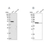 Anti-FDXR antibody produced in rabbit Prestige Antibodies&#174; Powered by Atlas Antibodies, affinity isolated antibody, buffered aqueous glycerol solution