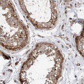 Anti-MKL1 antibody produced in rabbit Prestige Antibodies&#174; Powered by Atlas Antibodies, affinity isolated antibody, buffered aqueous glycerol solution