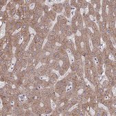 Anti-ITPR2 antibody produced in rabbit Prestige Antibodies&#174; Powered by Atlas Antibodies, affinity isolated antibody, buffered aqueous glycerol solution
