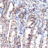 Anti-VPS11 antibody produced in rabbit