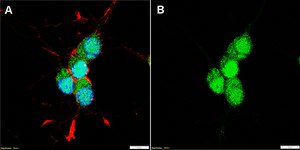 Anti-TBR1 Antibody, clone 1D16 ZooMAb&#174; Rabbit Monoclonal recombinant, expressed in HEK 293 cells