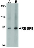 Anti-RBBP8 antibody produced in rabbit affinity isolated antibody, buffered aqueous solution