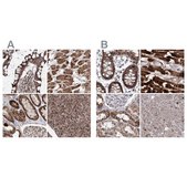 Anti-PDHX antibody produced in rabbit Prestige Antibodies&#174; Powered by Atlas Antibodies, affinity isolated antibody, buffered aqueous glycerol solution