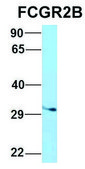 Anti-FCGR2B (C-terminal) antibody produced in rabbit affinity isolated antibody