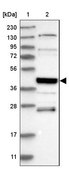 Anti-SMAP2 antibody produced in rabbit Prestige Antibodies&#174; Powered by Atlas Antibodies, affinity isolated antibody, buffered aqueous glycerol solution, Ab2