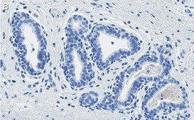 Anti-PTEN Antibody, clone 6B12 ZooMAb® Rabbit Monoclonal recombinant, expressed in HEK 293 cells