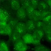 A549 Cells GFP-SMAD4