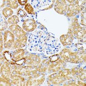 Anti- ECE1 antibody produced in rabbit