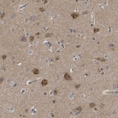 Anti-FIS1 antibody produced in rabbit Prestige Antibodies&#174; Powered by Atlas Antibodies, affinity isolated antibody, buffered aqueous glycerol solution