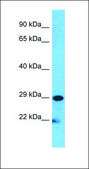 Anti-MUC1 affinity isolated antibody