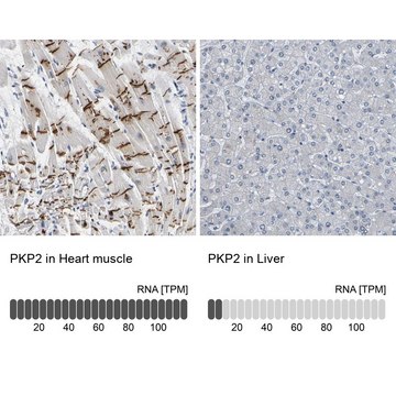 Anti-PKP2 antibody produced in rabbit Prestige Antibodies&#174; Powered by Atlas Antibodies, affinity isolated antibody, buffered aqueous glycerol solution
