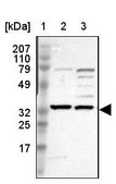 Anti-SLC25A21 antibody produced in rabbit Prestige Antibodies&#174; Powered by Atlas Antibodies, affinity isolated antibody, buffered aqueous glycerol solution