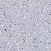 Anti-GZMA antibody produced in rabbit Prestige Antibodies&#174; Powered by Atlas Antibodies, affinity isolated antibody, buffered aqueous glycerol solution