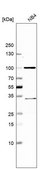 Anti-KCND1 antibody produced in rabbit Prestige Antibodies&#174; Powered by Atlas Antibodies, affinity isolated antibody, buffered aqueous glycerol solution