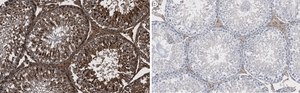 Anti-Actin Antibody, clone C4 ZooMAb&#174; Mouse Monoclonal recombinant, expressed in HEK 293 cells