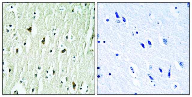 Anti-CSK antibody produced in rabbit affinity isolated antibody