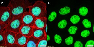 Anti-CBX3/HP1&#947; Antibody, clone 1K5 ZooMAb&#174; Rabbit Monoclonal recombinant, expressed in HEK 293 cells