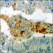 Anti-phospho-ITGB4 (pTyr1510) antibody produced in rabbit affinity isolated antibody