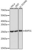 Anti-BAP31 antibody produced in rabbit
