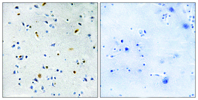 Anti-DIL-2 antibody produced in rabbit affinity isolated antibody