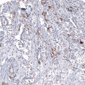 Anti-L1CAM antibody produced in mouse Prestige Antibodies&#174; Powered by Atlas Antibodies, clone CL12984, purified by using Protein A, buffered aqueous glycerol solution