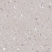 Anti-P2RY10 antibody produced in rabbit Prestige Antibodies® Powered by Atlas Antibodies, affinity isolated antibody, buffered aqueous glycerol solution