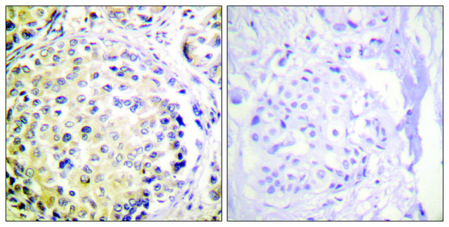 Anti-Vimentin antibody produced in rabbit affinity isolated antibody
