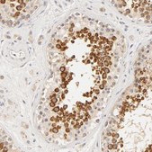 Anti-RPGR antibody produced in rabbit Prestige Antibodies&#174; Powered by Atlas Antibodies, affinity isolated antibody, buffered aqueous glycerol solution