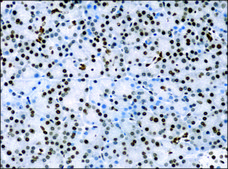 Anti-methyl-Histone H3 (Me-Lys4) antibody produced in rabbit affinity isolated antibody, buffered aqueous solution