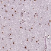 Monoclonal Anti-BRD4 antibody produced in mouse Prestige Antibodies&#174; Powered by Atlas Antibodies, clone CL1118, purified immunoglobulin, buffered aqueous glycerol solution