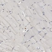 Anti-PTPN6 antibody produced in rabbit Prestige Antibodies&#174; Powered by Atlas Antibodies, affinity isolated antibody, buffered aqueous glycerol solution