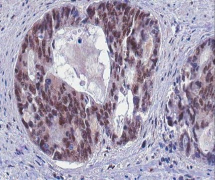 Anti-GADD45 alpha Antibody from rabbit, purified by affinity chromatography