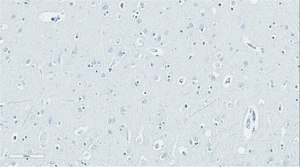 Anti-ApoE4 Fragment nApoECF Antibody (Asp172) from rabbit, purified by affinity chromatography